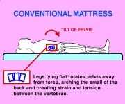 conventional mattress is bad for your back